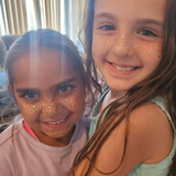 Glitter Girl Glitter Freckles applied on cheeks and nose for a dazzling, sun-kissed sparkle.